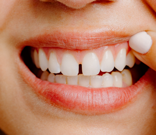 Woman smiling and touching her gums with her finger